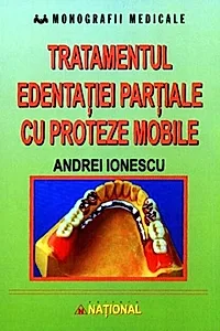 Tratamentul edentației parțiale cu proteze mobile