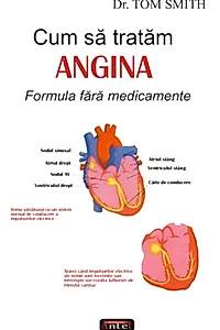 Cum să tratăm angina