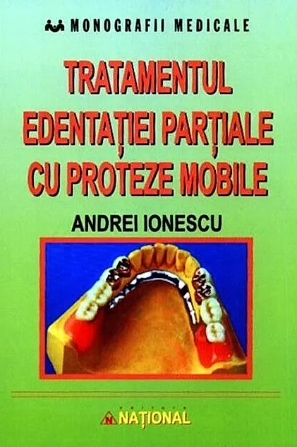 Tratamentul edentației parțiale cu proteze mobile