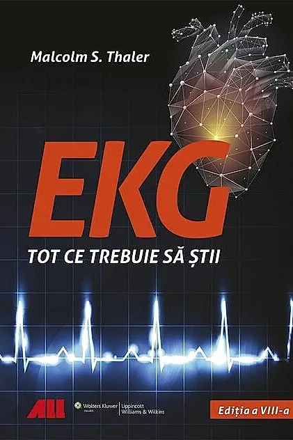 EKG - Tot ce trebuie să știi