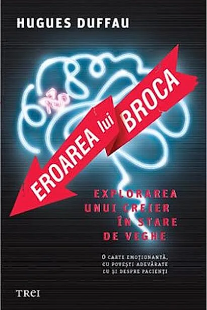 Eroarea lui Broca