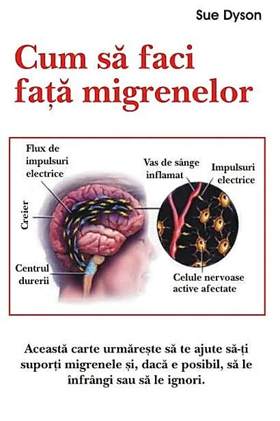 Cum să faci faţă migrenelor