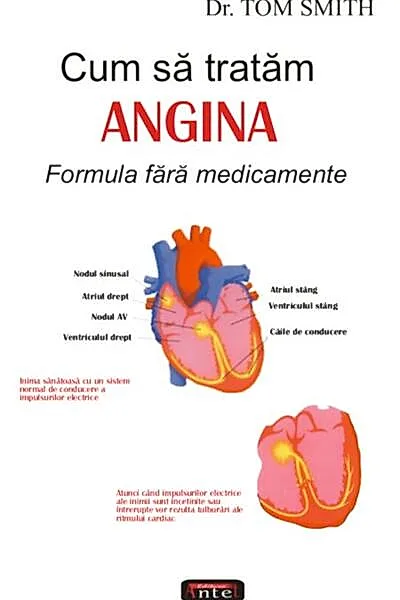 Cum să tratăm angina
